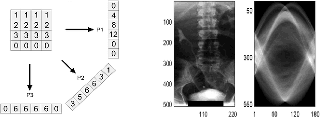 Figure 1 for Local Radon Descriptors for Image Search