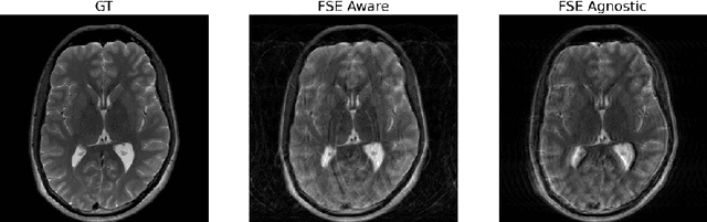 Figure 4 for FSE Compensated Motion Correction for MRI Using Data Driven Methods