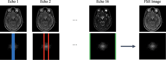 Figure 1 for FSE Compensated Motion Correction for MRI Using Data Driven Methods
