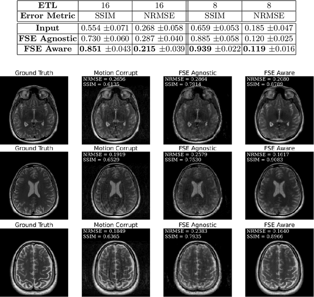 Figure 2 for FSE Compensated Motion Correction for MRI Using Data Driven Methods