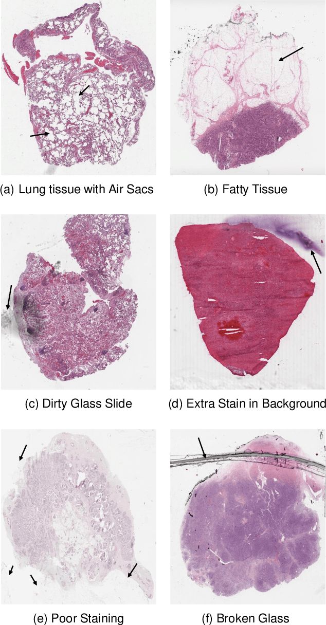 Figure 1 for A Comparative Study of U-Net Topologies for Background Removal in Histopathology Images