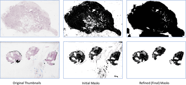 Figure 3 for A Comparative Study of U-Net Topologies for Background Removal in Histopathology Images