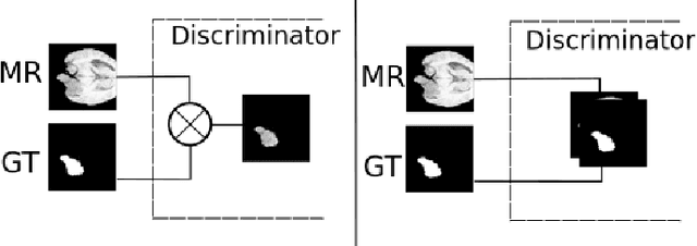 Figure 1 for Transfer Brain MRI Tumor Segmentation Models Across Modalities with Adversarial Networks
