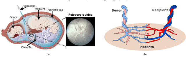 Figure 1 for FetReg2021: A Challenge on Placental Vessel Segmentation and Registration in Fetoscopy