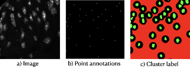 Figure 3 for Weakly Supervised Deep Instance Nuclei Detection using Points Annotation in 3D Cardiovascular Immunofluorescent Images