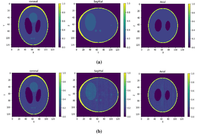 Figure 4 for Uniformly Sampled Polar and Cylindrical Grid Approach for 2D, 3D Image Reconstruction using Algebraic Algorithm