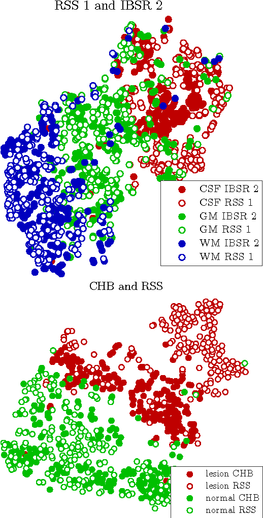 Figure 3 for Transfer Learning by Asymmetric Image Weighting for Segmentation across Scanners