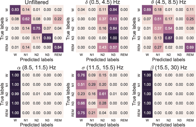 Figure 2 for A deep learning architecture for temporal sleep stage classification using multivariate and multimodal time series