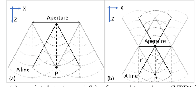 Figure 1 for Image enhancement in acoustic-resolution photoacoustic microscopy enabled by a novel directional algorithm