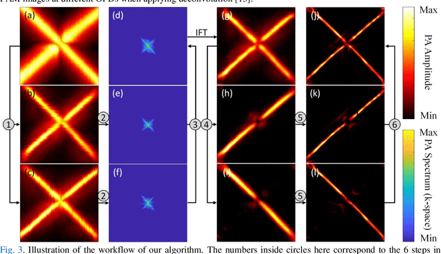 Figure 4 for Image enhancement in acoustic-resolution photoacoustic microscopy enabled by a novel directional algorithm