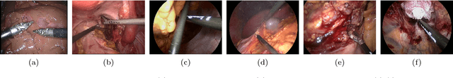 Figure 3 for Comparative evaluation of instrument segmentation and tracking methods in minimally invasive surgery