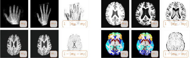 Figure 2 for Constrained $H^1$-regularization schemes for diffeomorphic image registration