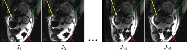 Figure 1 for Temporal Registration in In-Utero Volumetric MRI Time Series