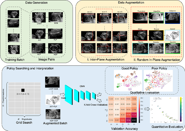 Figure 1 for Principled Ultrasound Data Augmentation for Classification of Standard Planes