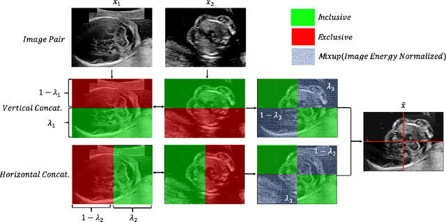 Figure 3 for Principled Ultrasound Data Augmentation for Classification of Standard Planes
