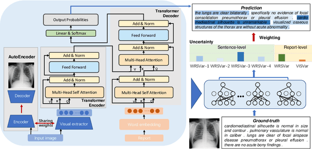 Figure 1 for Confidence-Guided Radiology Report Generation