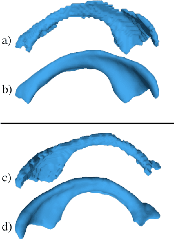 Figure 3 for A Fast, Semi-Automatic Brain Structure Segmentation Algorithm for Magnetic Resonance Imaging