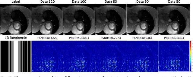 Figure 3 for LANTERN: learn analysis transform network for dynamic magnetic resonance imaging with small dataset