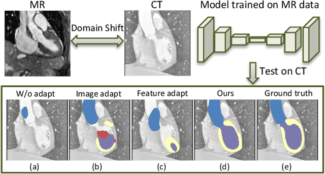 Figure 1 for Synergistic Image and Feature Adaptation: Towards Cross-Modality Domain Adaptation for Medical Image Segmentation