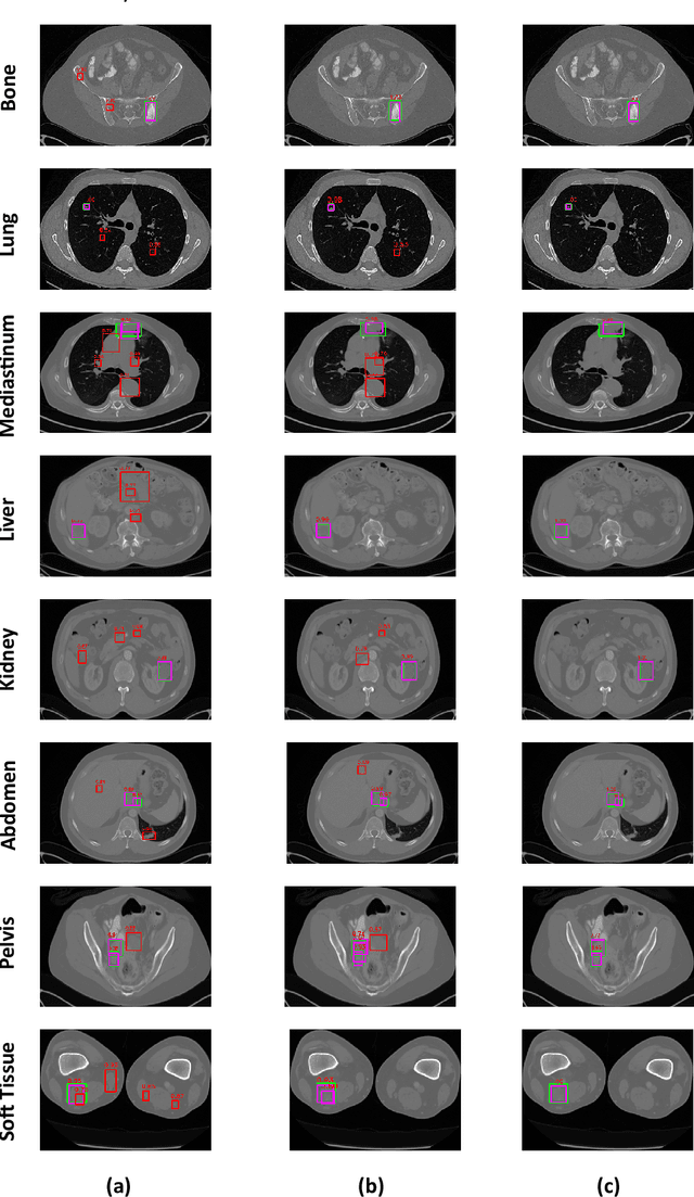 Figure 2 for DKMA-ULD: Domain Knowledge augmented Multi-head Attention based Robust Universal Lesion Detection