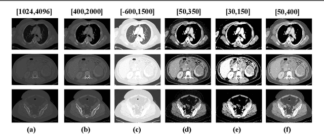 Figure 3 for DKMA-ULD: Domain Knowledge augmented Multi-head Attention based Robust Universal Lesion Detection