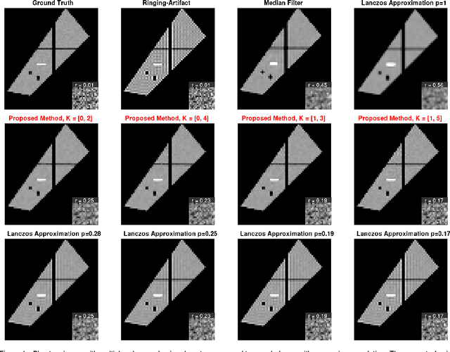 Figure 4 for Gibbs-Ringing Artifact Removal Based on Local Subvoxel-shifts