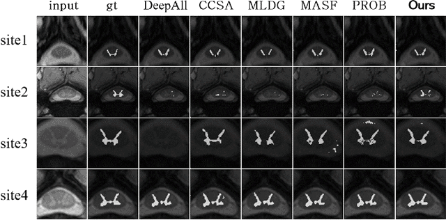 Figure 2 for Domain Generalization for Medical Imaging Classification with Linear-Dependency Regularization