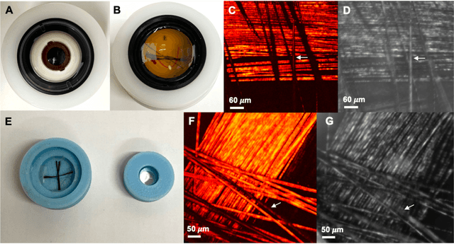 Figure 2 for In vivo functional and structural retina imaging using multimodal photoacoustic remote sensing microscopy and optical coherence tomography