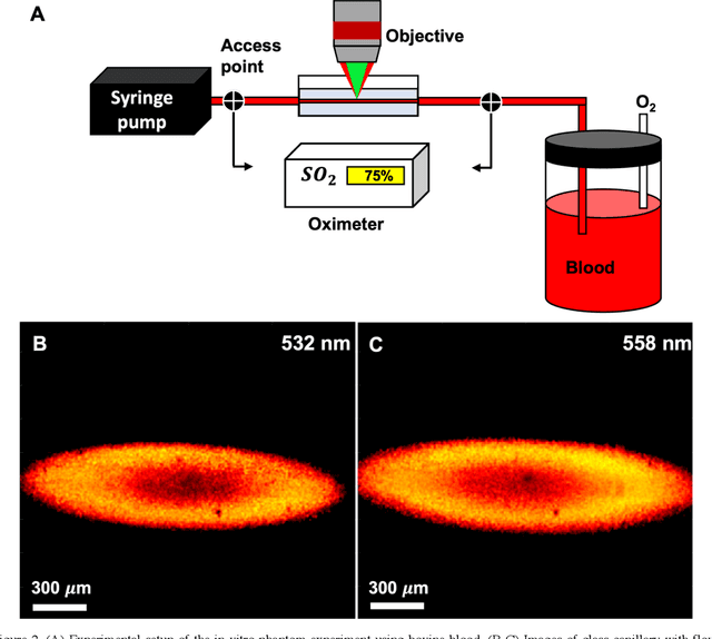 Figure 3 for In vivo functional and structural retina imaging using multimodal photoacoustic remote sensing microscopy and optical coherence tomography