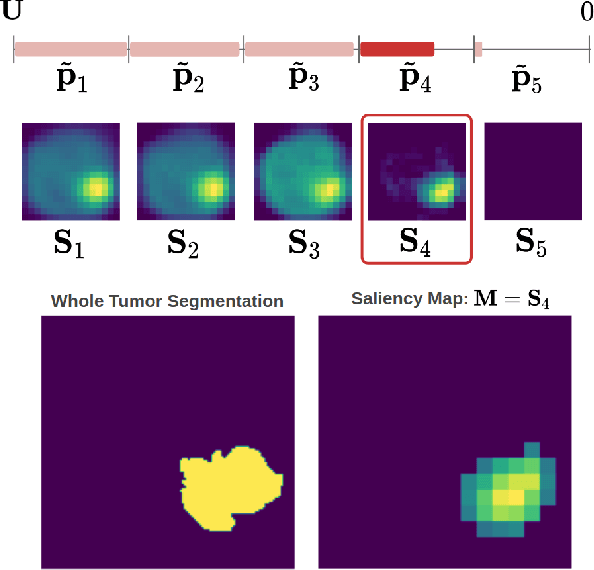 Figure 3 for Post-hoc Overall Survival Time Prediction from Brain MRI