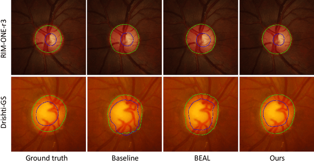 Figure 3 for Unsupervised Domain Adaptive Fundus Image Segmentation with Category-level Regularization