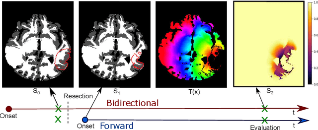 Figure 2 for Evaluating glioma growth predictions as a forward ranking problem