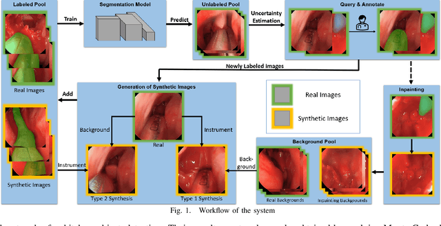 Figure 1 for Reducing Annotating Load: Active Learning with Synthetic Images in Surgical Instrument Segmentation