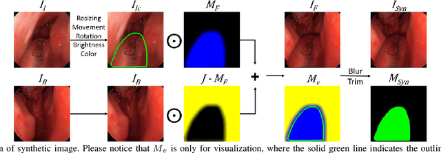 Figure 3 for Reducing Annotating Load: Active Learning with Synthetic Images in Surgical Instrument Segmentation