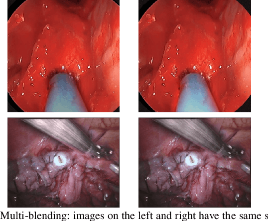Figure 4 for Reducing Annotating Load: Active Learning with Synthetic Images in Surgical Instrument Segmentation