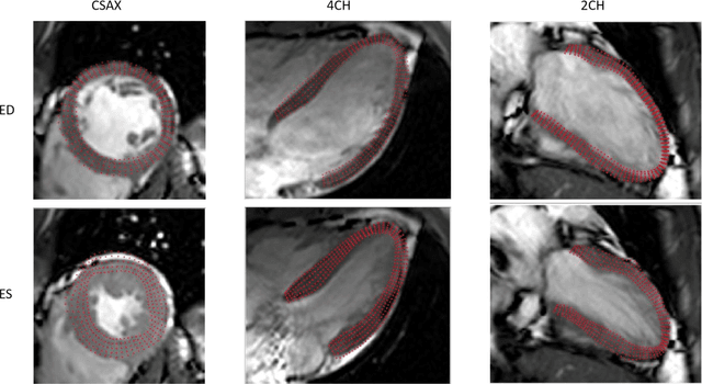 Figure 1 for Enhanced 3D Myocardial Strain Estimation from Multi-View 2D CMR Imaging