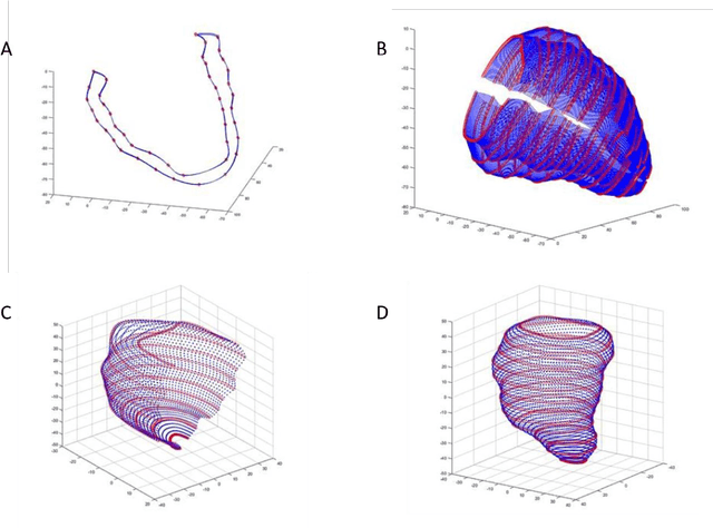Figure 4 for Enhanced 3D Myocardial Strain Estimation from Multi-View 2D CMR Imaging