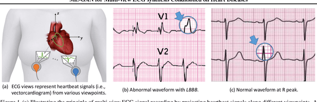 Figure 1 for ME-GAN: Learning Panoptic Electrocardio Representations for Multi-view ECG Synthesis Conditioned on Heart Diseases