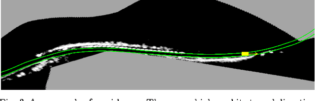 Figure 4 for Robust Deep-Learning-Based Road-Prediction for Augmented Reality Navigation Systems