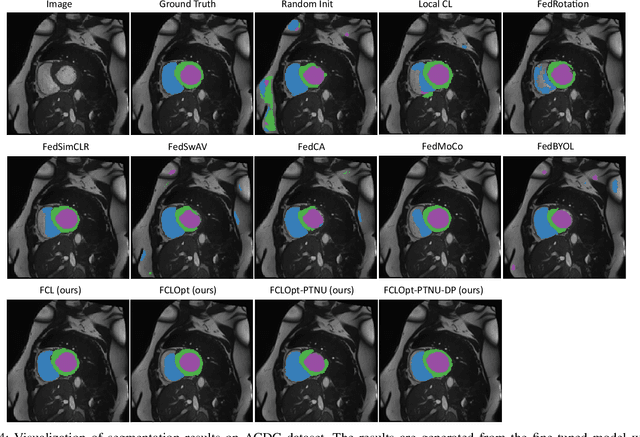 Figure 4 for Distributed Contrastive Learning for Medical Image Segmentation