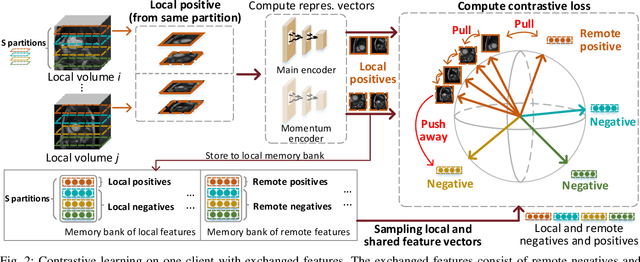 Figure 2 for Distributed Contrastive Learning for Medical Image Segmentation