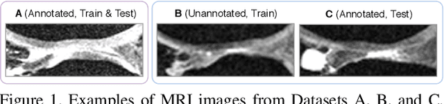 Figure 1 for Improving Robustness of Deep Learning Based Knee MRI Segmentation: Mixup and Adversarial Domain Adaptation