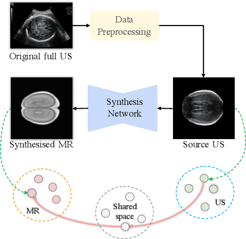 Figure 1 for Self-Supervised Ultrasound to MRI Fetal Brain Image Synthesis