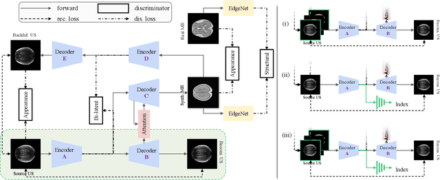 Figure 2 for Self-Supervised Ultrasound to MRI Fetal Brain Image Synthesis