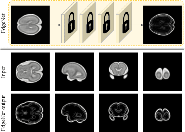 Figure 4 for Self-Supervised Ultrasound to MRI Fetal Brain Image Synthesis