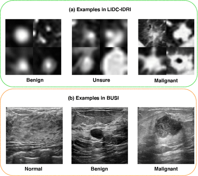 Figure 4 for Meta Ordinal Regression Forest for Medical Image Classification with Ordinal Labels