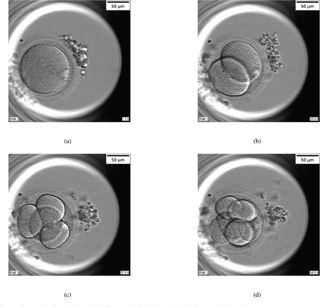 Figure 1 for Multi-Task Deep Learning with Dynamic Programming for Embryo Early Development Stage Classification from Time-Lapse Videos