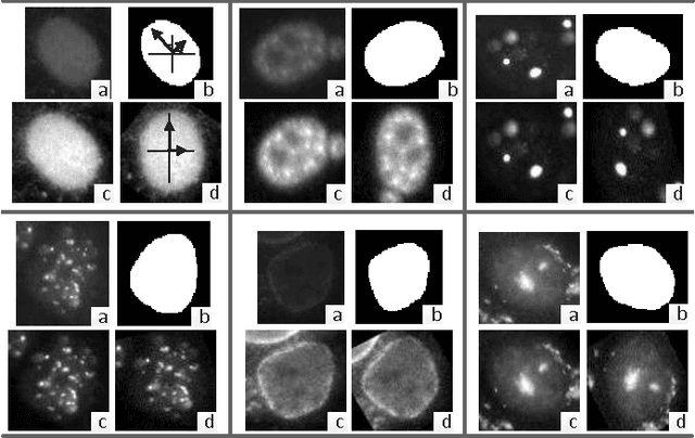 Figure 3 for HEp-2 Cell Image Classification with Deep Convolutional Neural Networks