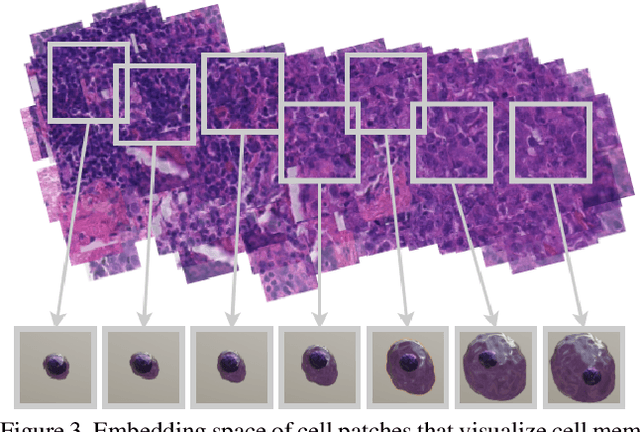 Figure 4 for Synthetic Generation of Three-Dimensional Cancer Cell Models from Histopathological Images