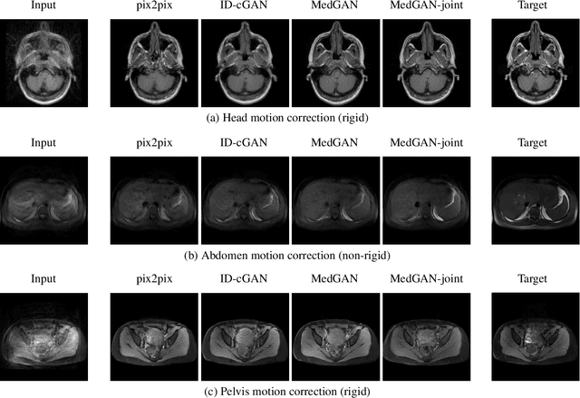 Figure 2 for Retrospective correction of Rigid and Non-Rigid MR motion artifacts using GANs